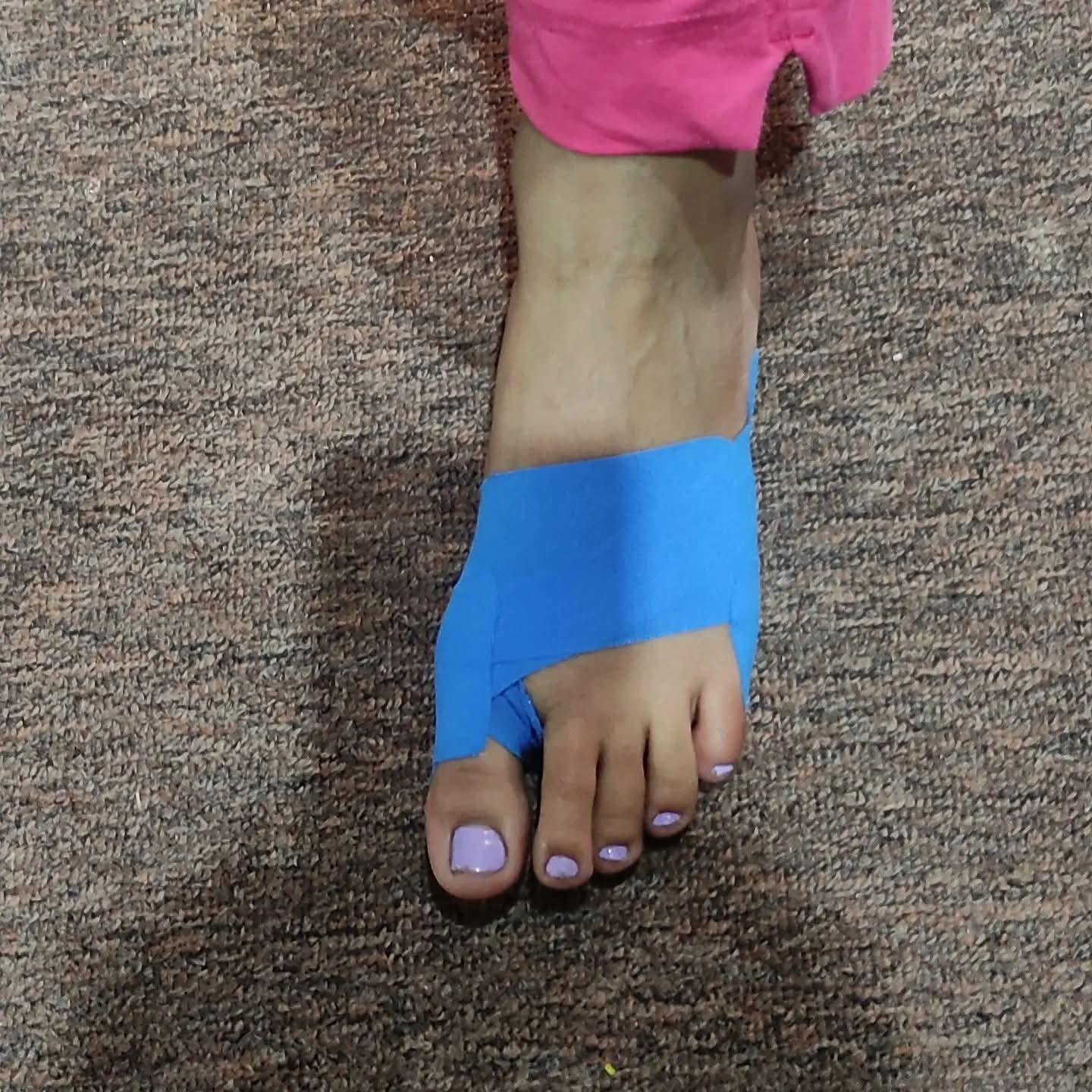 Neck and shoulder physiotherapy